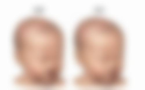 八、嘉兴华 山整形美容门诊部真实的顾客评价如下：