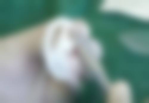 45岁抗衰：依据肌肤松弛选方法