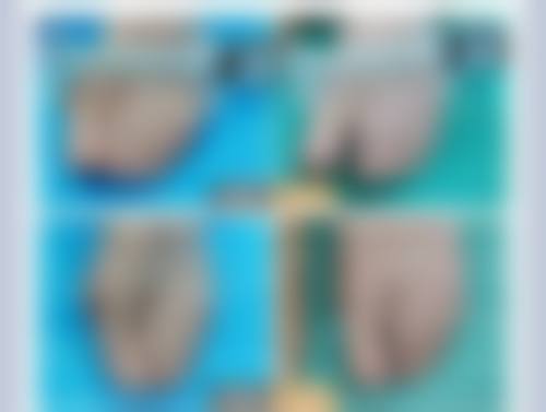 八、上海中瀛医疗美容真实的顾客评价如下：