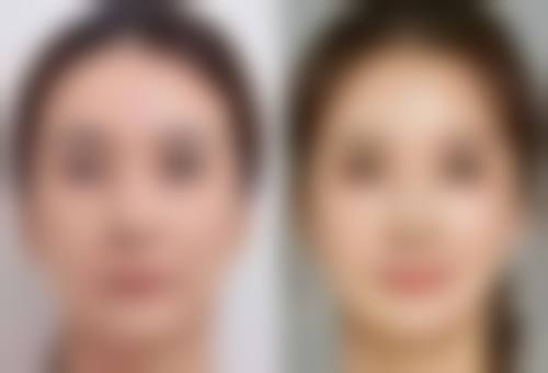 广西柳州华美医疗美容门诊部保妥适项目优势