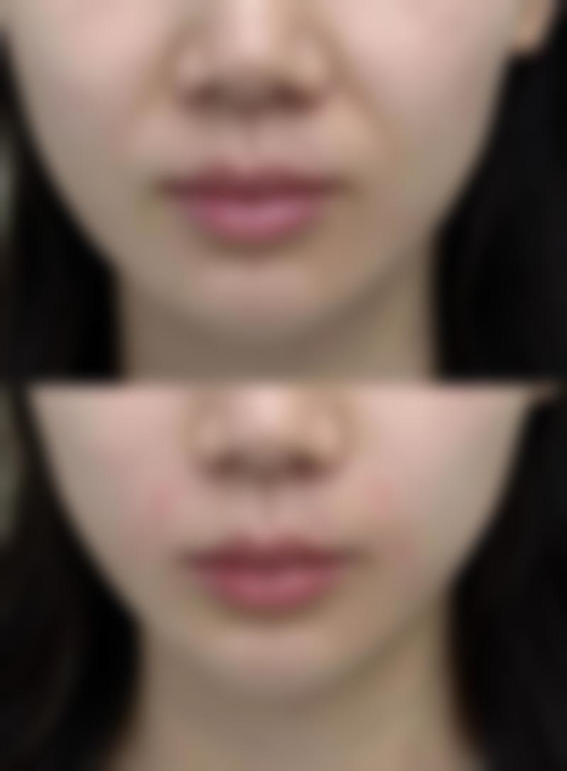 八、广州古汀医疗美容门诊真实的顾客评价如下：