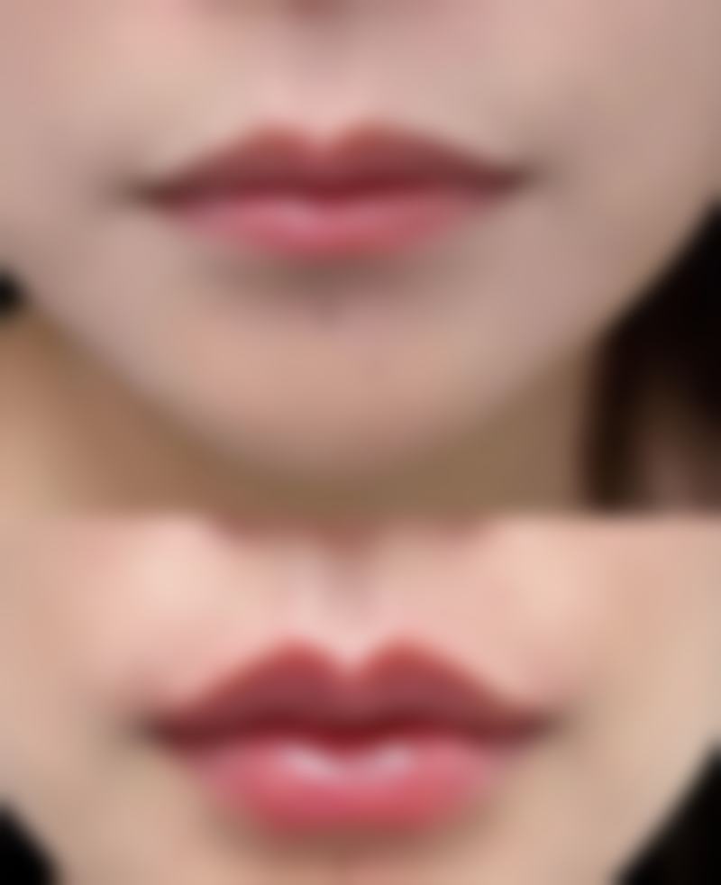 广州天河韩妃整形医院可靠吗？优质服务暖人心