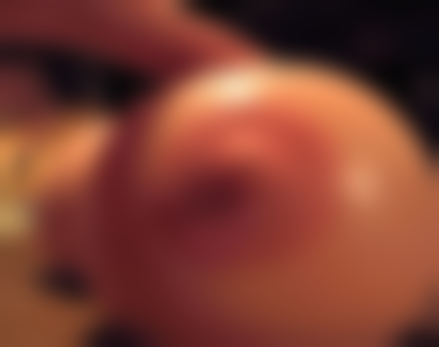 五、营口奉伊美整形医疗美容诊所实例