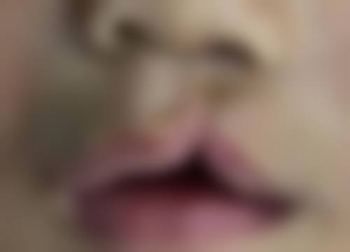 马鹏飞牙齿种植水平怎么样可靠吗？