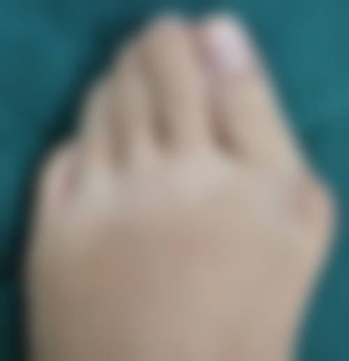 五、上海瑞东医院整形科怎么预约：