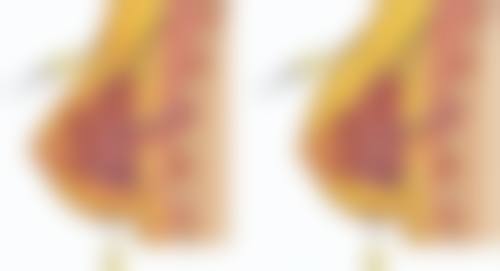 四、上海瑞东医院整形科实例