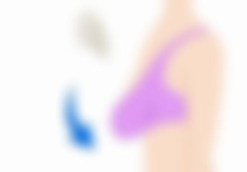 四、海南海口叶安娜整形医院实例