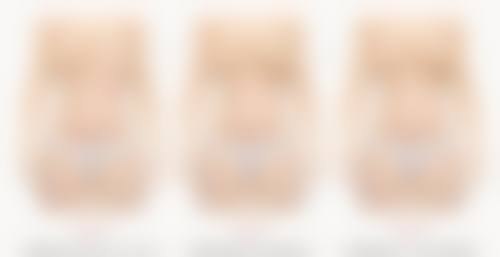 蒋克锋牙齿美容修复水平怎么样可靠吗?