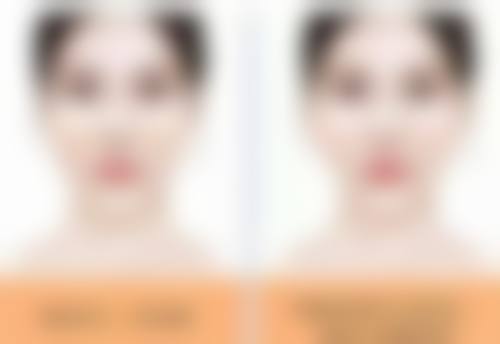 五、宜宾翠屏华彩医疗美容诊所实例