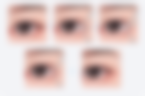 安纲颅颌面外科实例