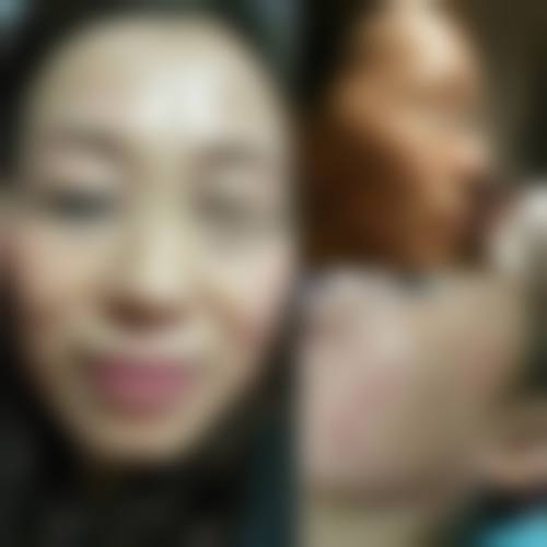 魏海艳激光美容水平怎么样可靠吗？