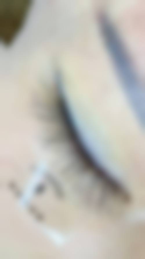 崔义泽植发实例