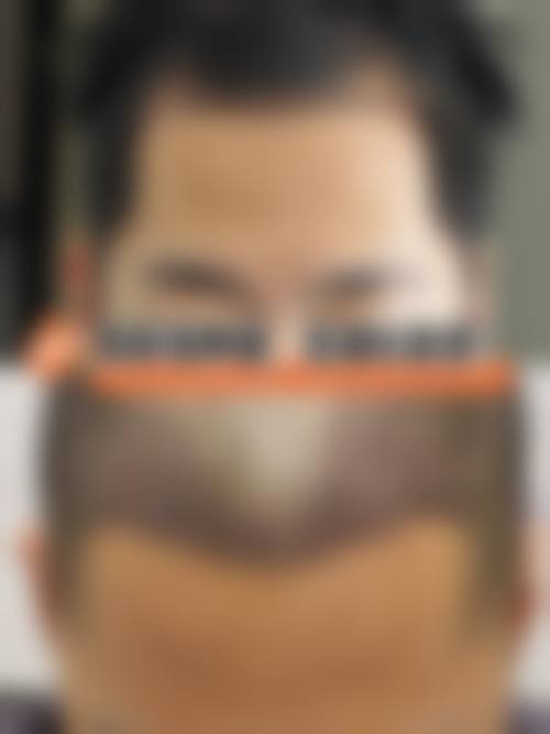 崔义泽项目价格表参考