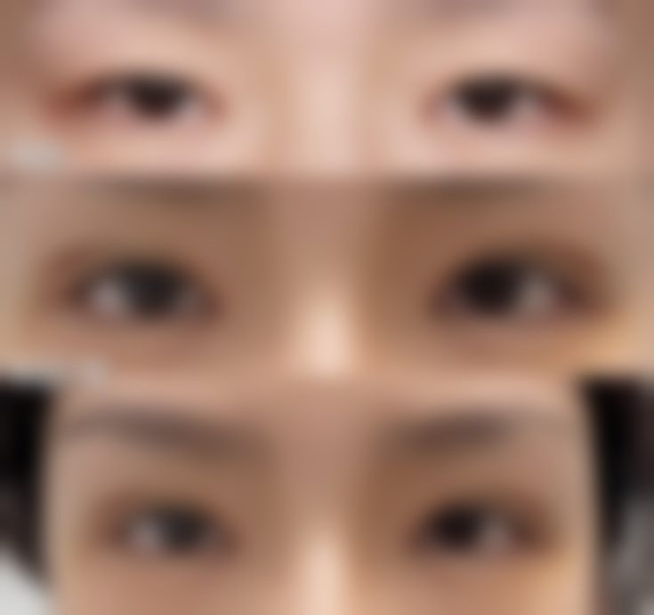 五、呼和浩特蕊儿医疗美容诊所实例