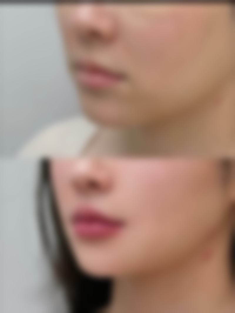 五、厦门莫琳娜国内外整形医疗美容集团（原174整形美容科）怎么预约：