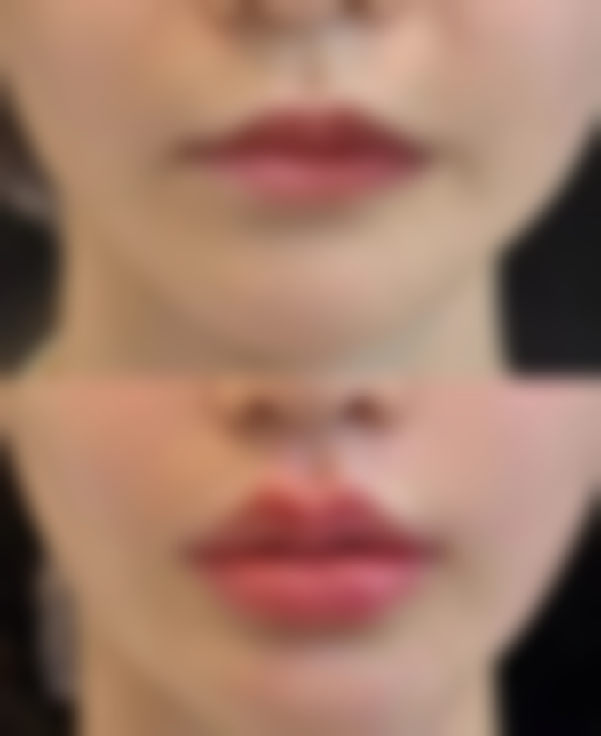 七、宜宾翠屏华彩医疗美容诊所价格表：（仅供参考）