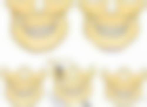 四、毛多毛毛发移植（原布莱克）基本信息：