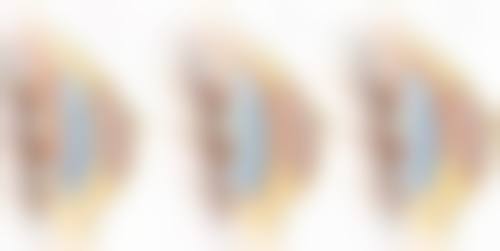 肋软骨隆鼻：真实实例见证神奇成效