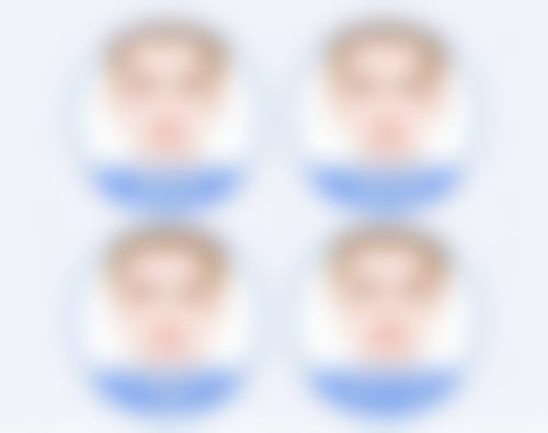 有哪些医院能做线提升去眼袋？