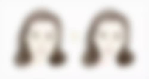 胸前痘痘留疤疙瘩不愁！医院口碑好助你修复美肌