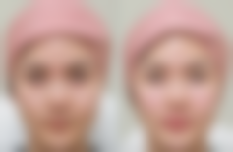 揭秘至佳隆胸手术：专精医院，为美丽保驾护航