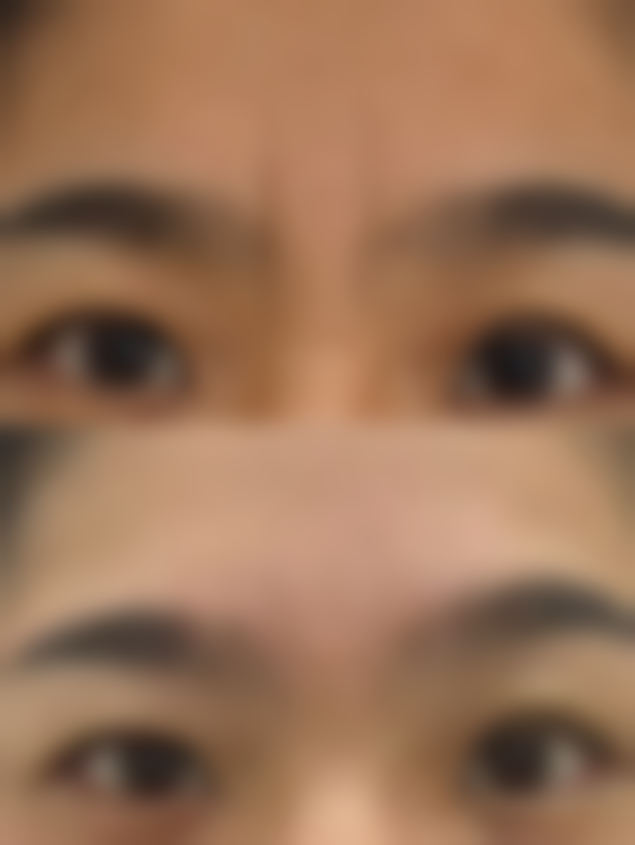 五、佛山佳丽大医疗美容实例