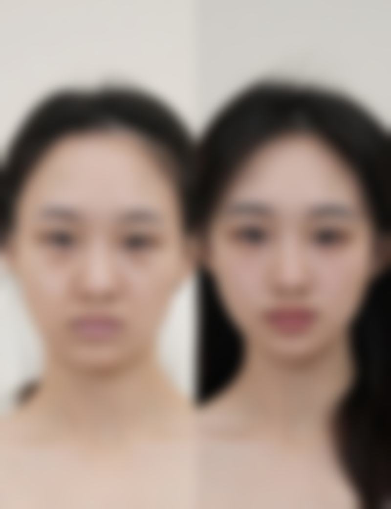 六、上海美漾整形医院价格表：（仅供参考）