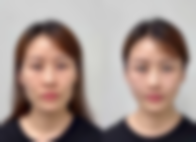 七、三明艾芙医疗美容门诊部价格表：（仅供参考）