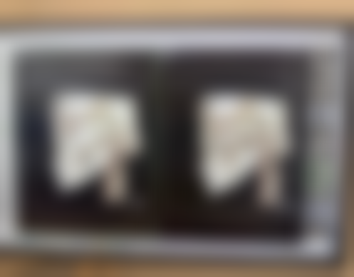 双眼皮显老之谜大揭秘：从设计到护理，多因素影响双眼皮年轻态效果