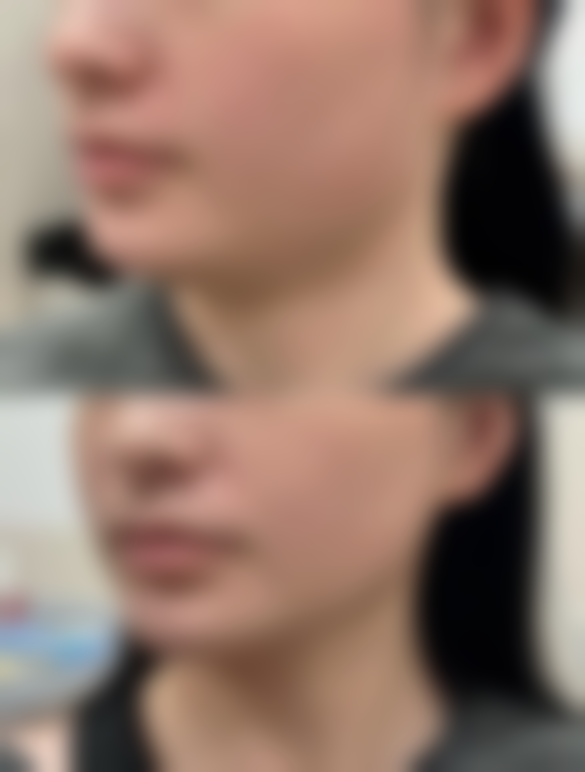 四、南京黛珍医疗美容诊所实例