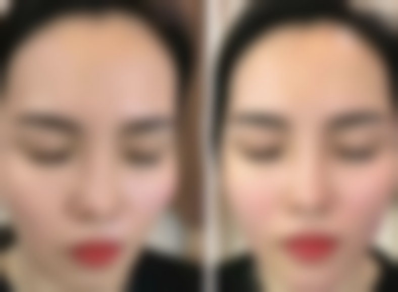 胸前痘痘留疤疙瘩别怕！了解医院环境让你治疗舒心