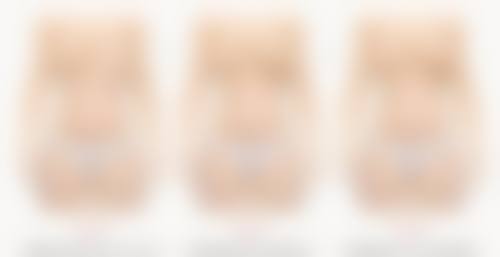 破解眼袋脂肪消除之谜：关注美学改善要点