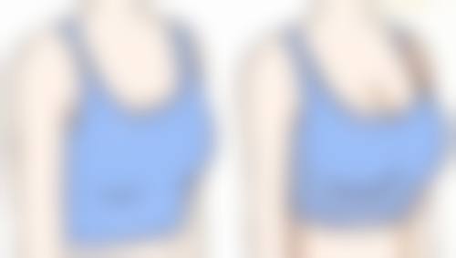 硅胶隆鼻术后消肿小贴士，让您更快修复容貌巅峰