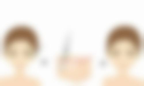 韩式隆鼻风险揭秘：感染、移位等危害几何？如何选医院规避风险 