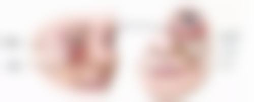 选择专精医院祛眼袋泪沟，优势亮点大揭秘