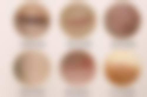 一般增生疤痕修复时间大揭秘：受多因素影响，6个月到2年或可稳定恢复