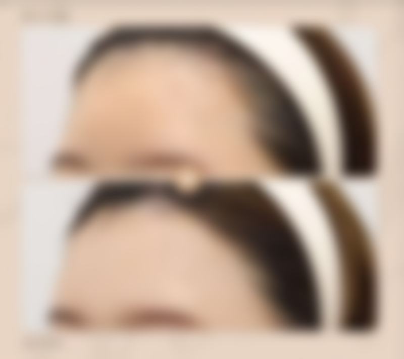 五、青岛瑧妍美医疗美容医院实例