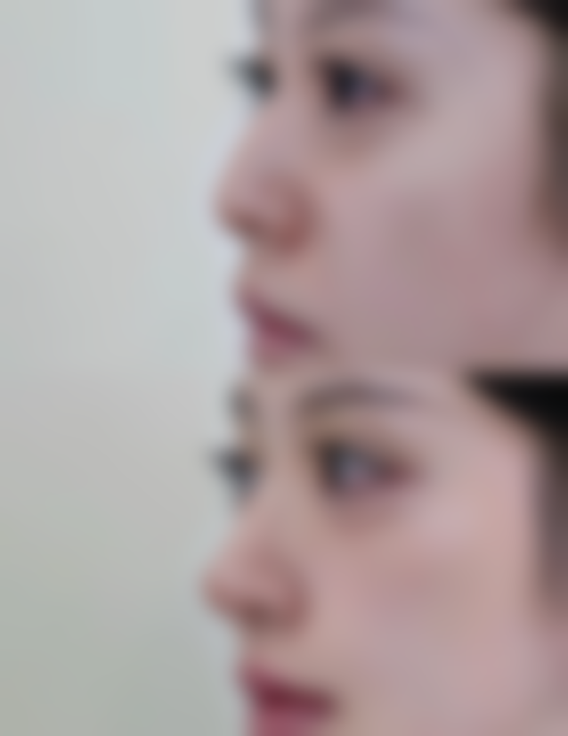 淡化疤痕神药使用注意事项大揭秘