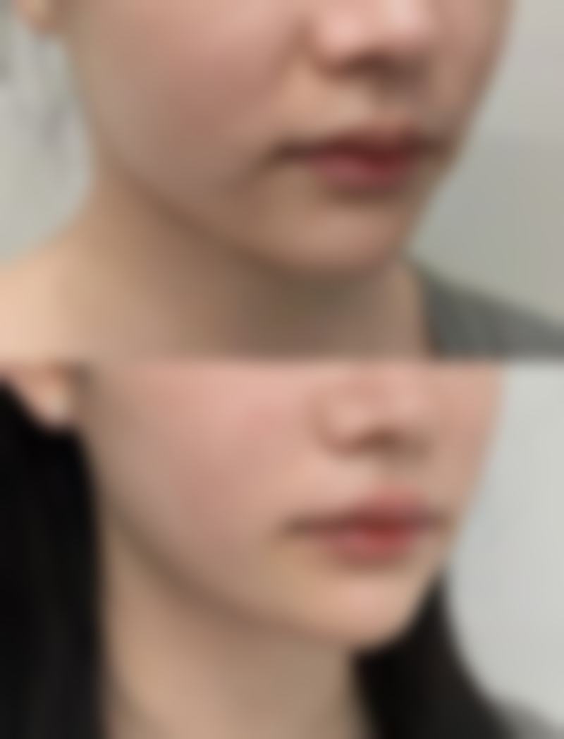 合理饮食搭配，助力美眼加速修复