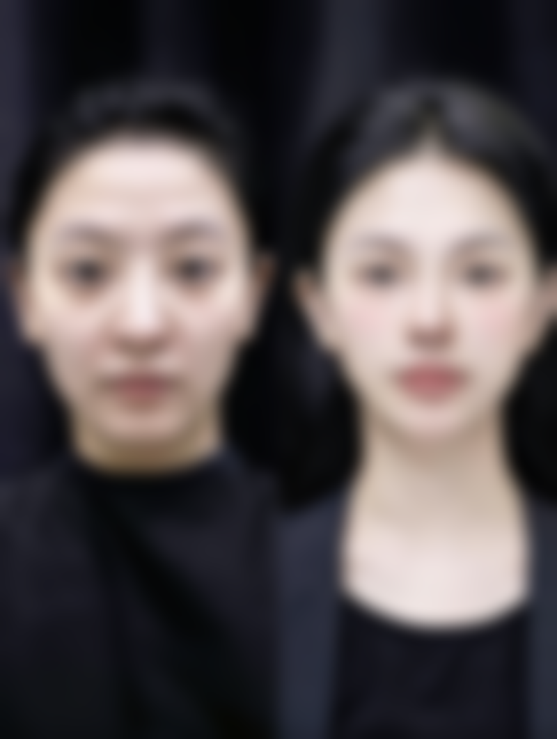 淡化疤痕的神药大揭秘！硅酮、维C类等药物，助你有效改善各类疤痕