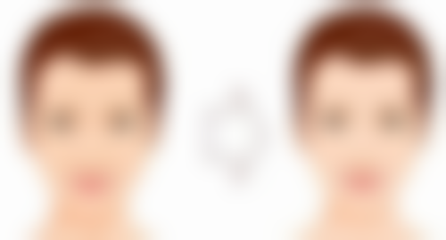 植入双眼皮能否永久？揭秘不同术式持久秘诀与优质医美医院选择攻略 