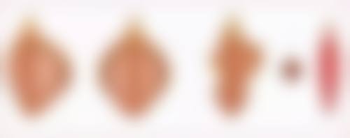 轻松告别熊猫眼和泡泡眼！医美手段来助力