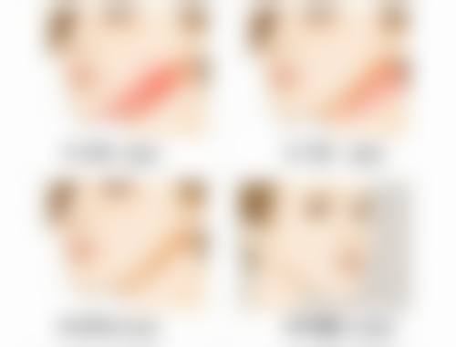 日常护理助力凸出疤痕变平