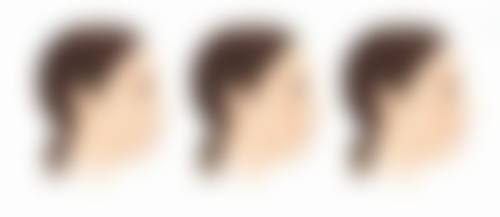 告别恼人眼袋！多种治疗方案任你选