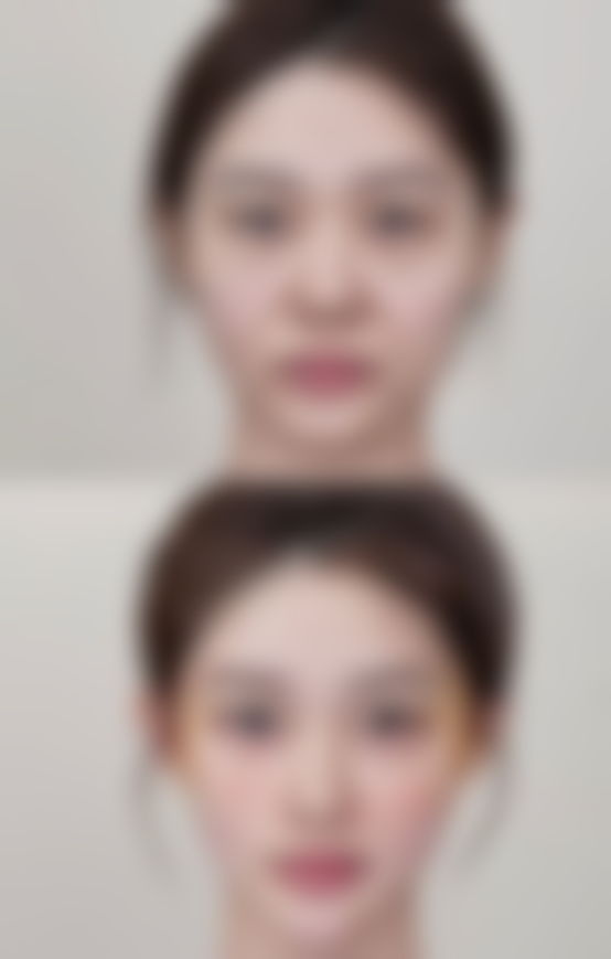 术后不同阶段，花生食用有讲究