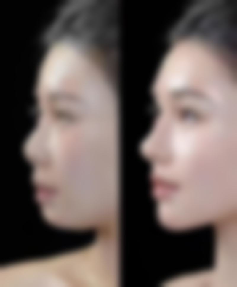 七、南京五洲医院（私密整形医学中 心）价格表：（仅供参考）