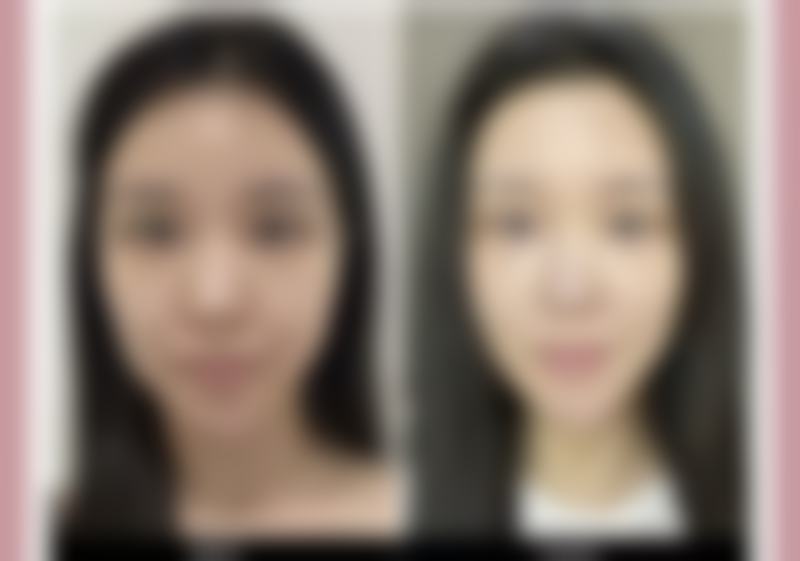 五、宁德东方秀丽华美整形医院怎么预约：