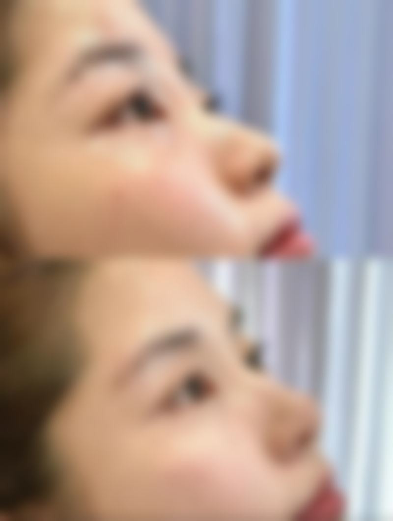 四、宁德东方秀丽华美整形医院实例