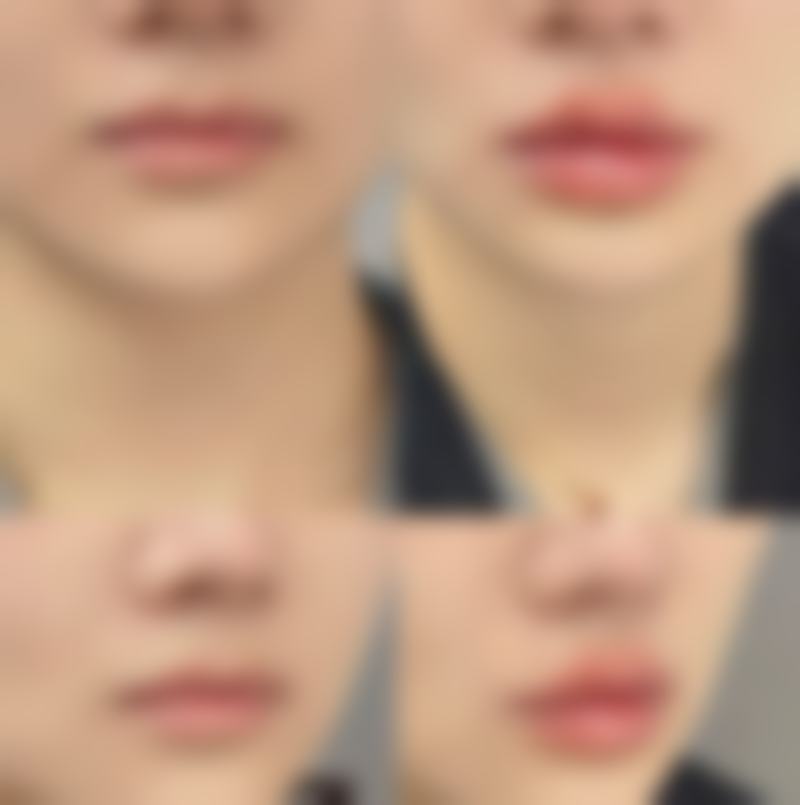 李戍波怎么预约？