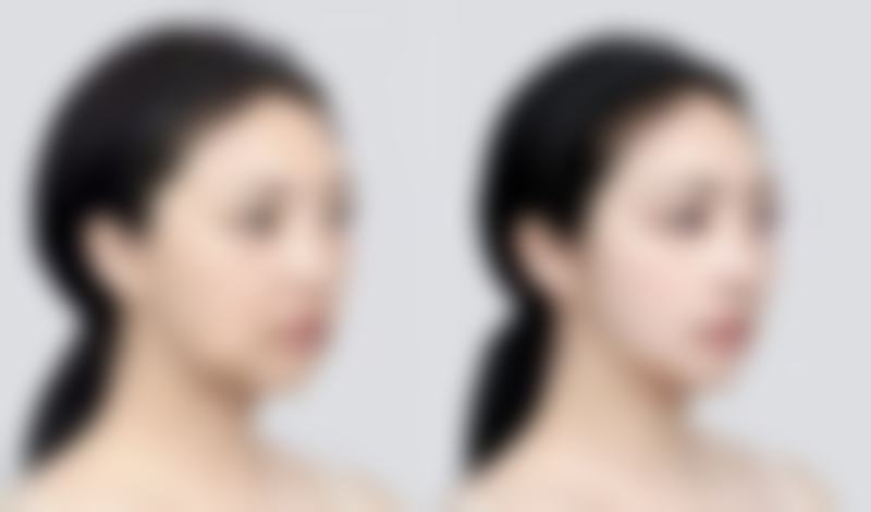 四、成都童颜博仕整形医疗美容门诊部实例